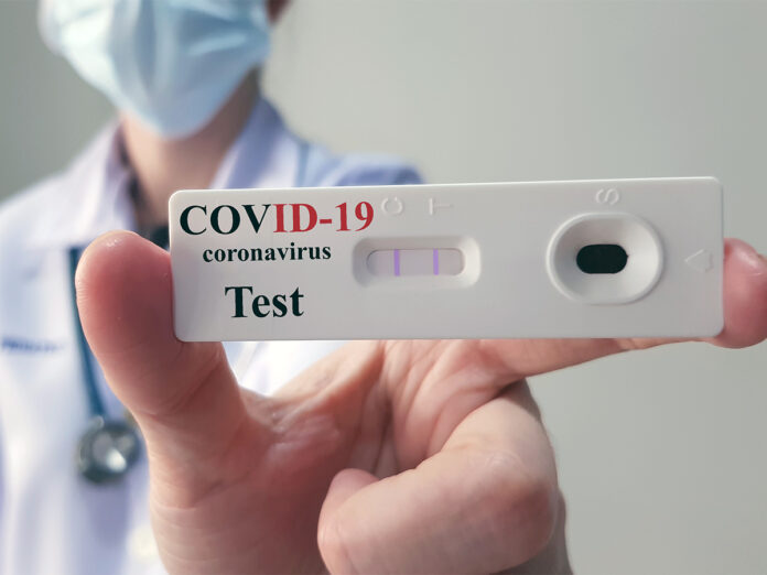 Prefeitura disponibiliza teste rápido para detecção da Covid-19 nas unidades de saúde da família